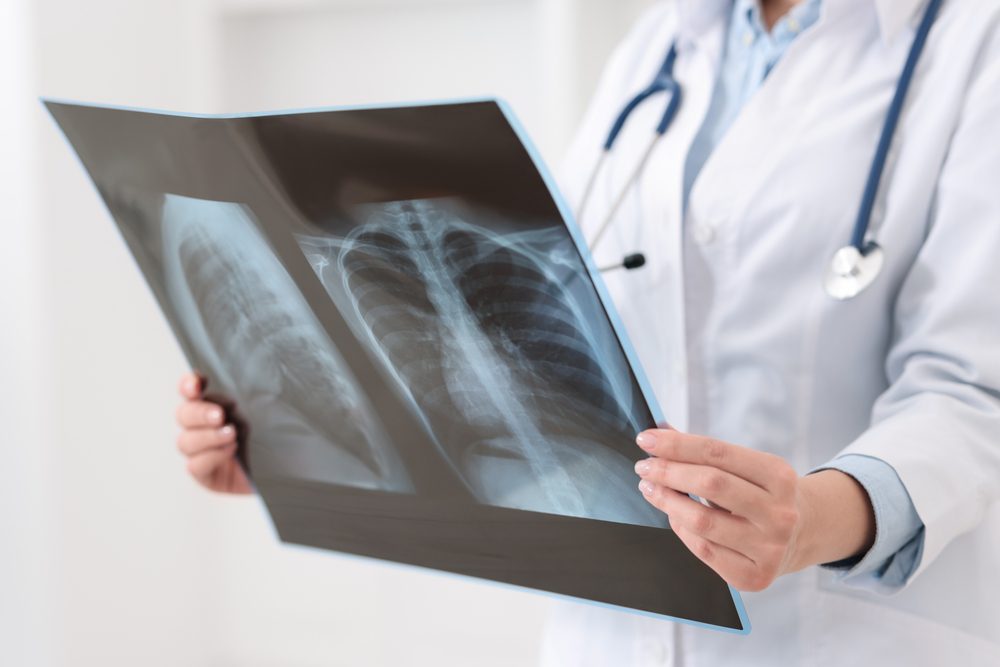 Urgent Care X-Ray Services in Shelby Township, MI: My Experience