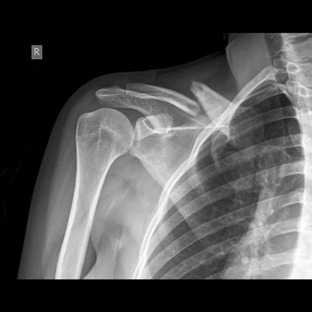 Same-Day X-Rays Near Shelby Township MI | Village Health